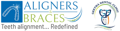 Aligners Braces